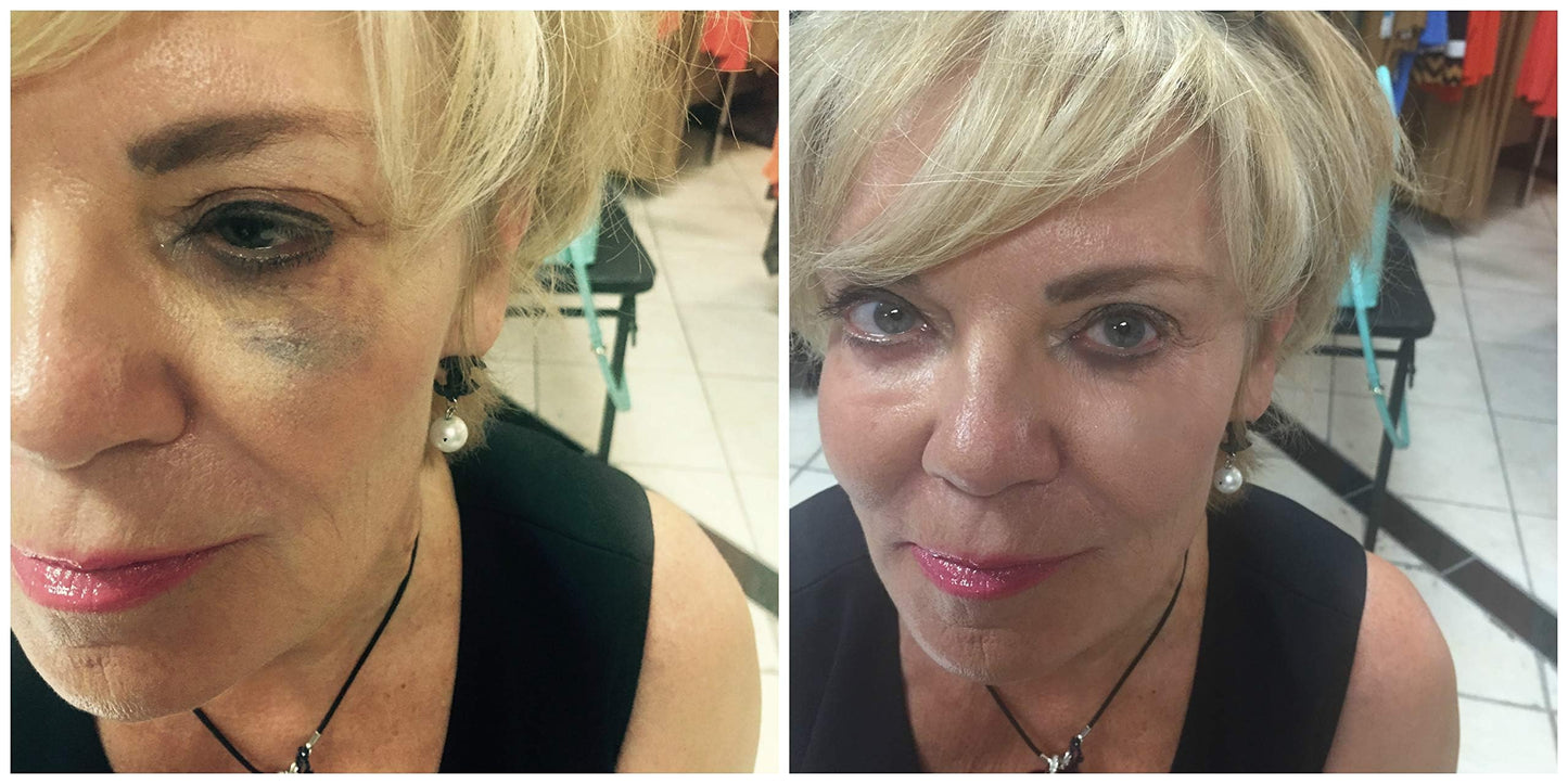 Judith August Killer Cover - Light/Medium - Cover Bruises, Tattoos, Age Spots, Vitiligo & More