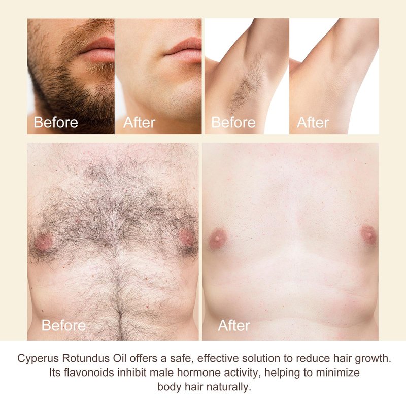 Cyperus Rotundus Oil 2 Pack, Cyperus Rotundus Oil for Hair Removal, Effectly Reducing Body Hair Growth, Moisturizing & Soothing Skin, 4 Fl oz