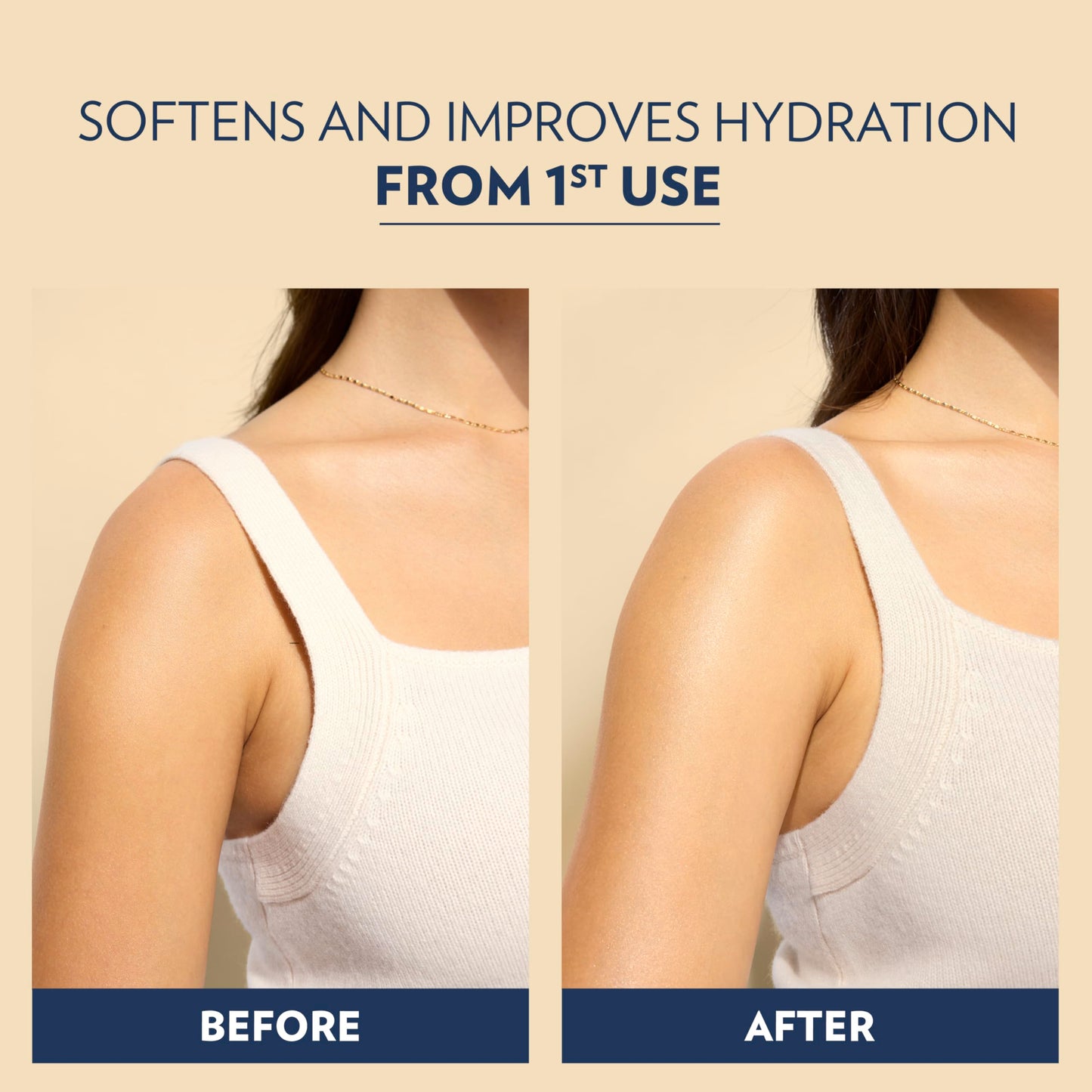 Vaseline Intensive Care Hand and Body Lotion For Dehydrated Skin Soothing Hydration Dry Skin Lotion with Aloe Vera Extract & Ultra-Hydrating Lipids 10 oz