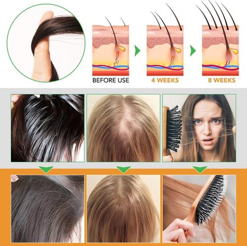Biotin Shampoo and Conditioner for Hair Loss| Thickening Hair Products with Rosemary, Black Castor & Batana Oil - Strengthens, Repair, Add Shine for Women Curly, Straight, Dry and Damaged Hair