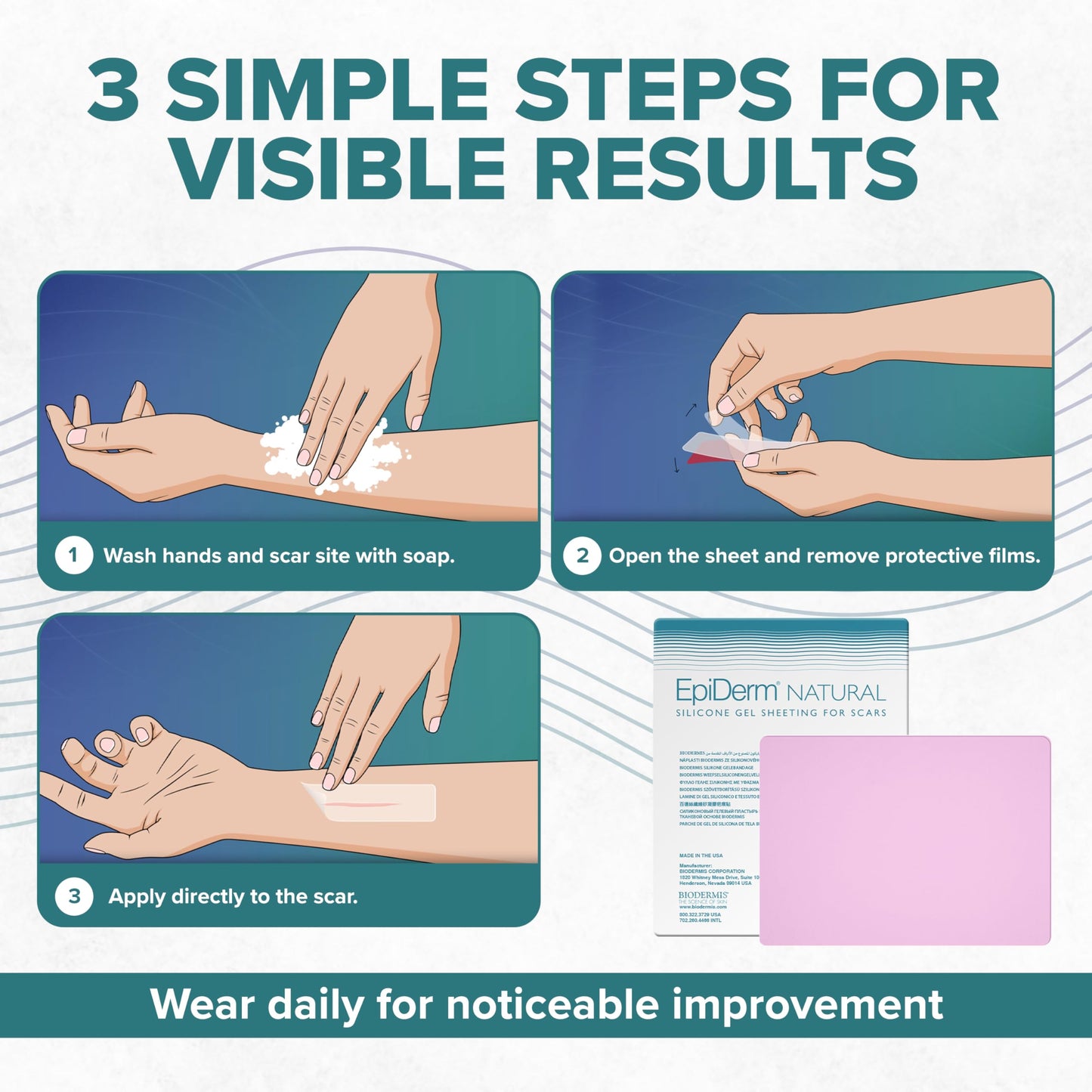 Epiderm Large Silicone Scar Sheets – Soft, Reusable Silicone Sheets for Tummy Tuck, C-Section, Burns & Surgical Scars – Customizable, Flexible & Easy to Clean – 11" x 15.75", Clear, 1 Sheet
