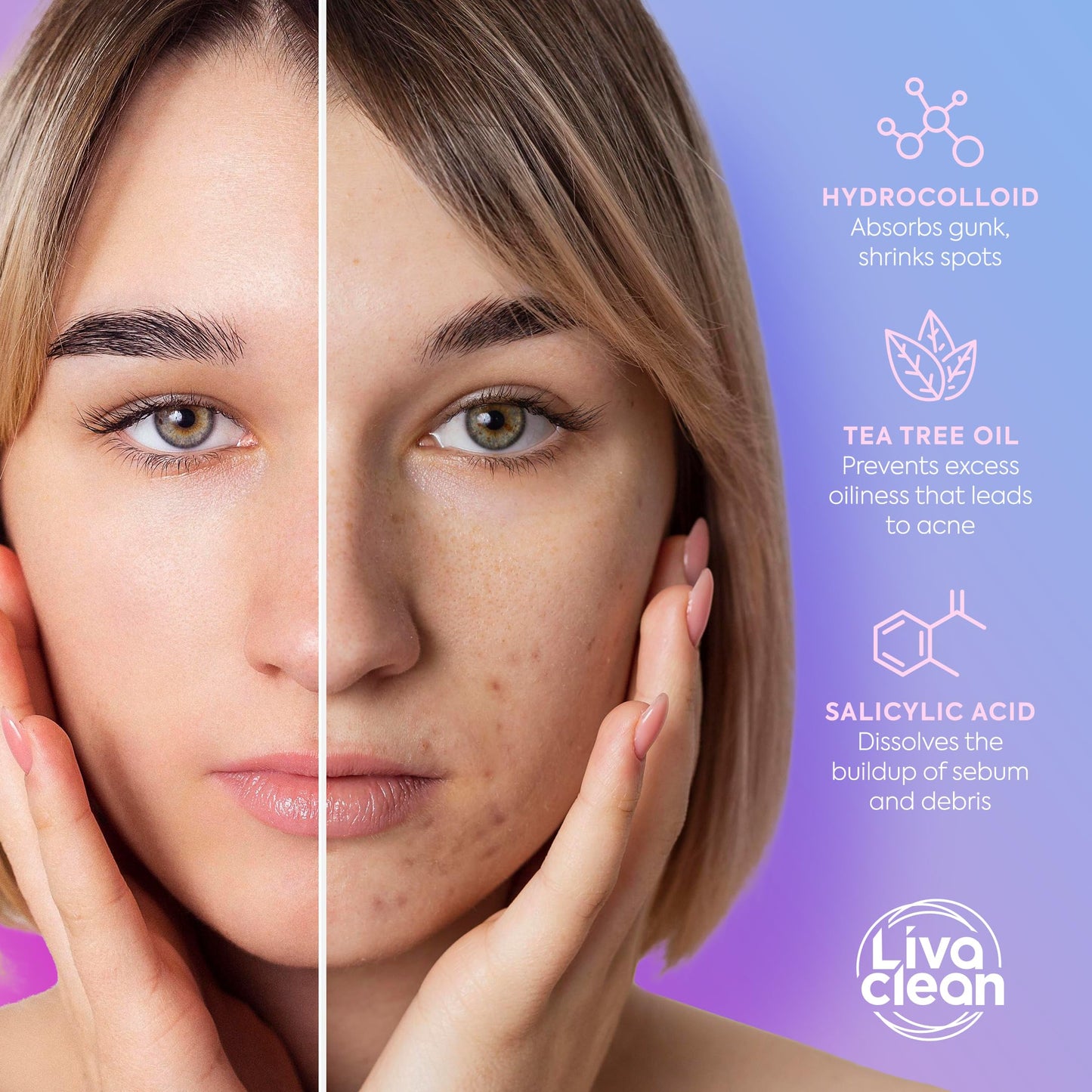 LivaClean 240 CT Cute Pimple Patches for Face w/Salicylic Acid & Tea Tree, Hydrocolloid Acne Patches Cute Flower Pimple Patch, Adorable Face Stickers, Zit Patch