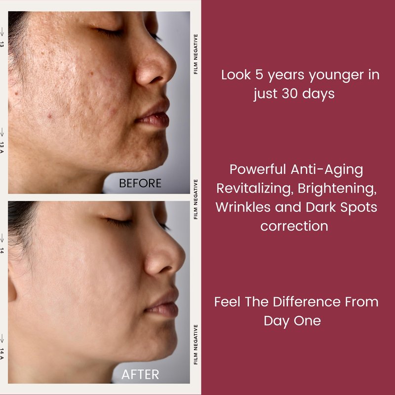 Turbinne Pure 2.5% Retinol Serum Capsules. Look 5 Years Younger In 30 Days. Powerful Anti -Aging, Deep Hydration, Brightening, Reduce Acne, Dark Spots & Wrinkles (30 Count)