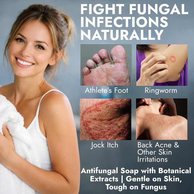 Antifungal Soap Infused with Shea Butter & Rose Oil | Medicated Jock Itch Treatment Helps Fight Ringworm & Athleteβs Foot | Tolnaftate 1% Antifungal Soap for Deep Cleansing | 2 Bars with Scrubber