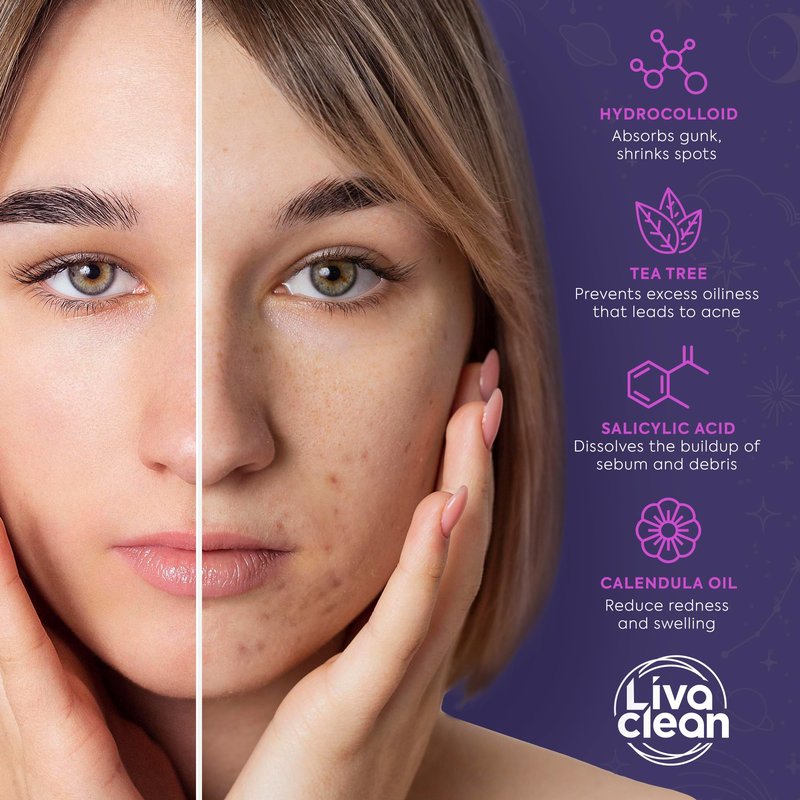 Livaclean 240 CT Star Pimple Patches for Face + 272 CT Variety Pack Large Acne Patches for Face and Body w/Tea Tree Oil, Salicylic Acid | Hydrocolloid Acne Patch | Cute Star Pimple Patch
