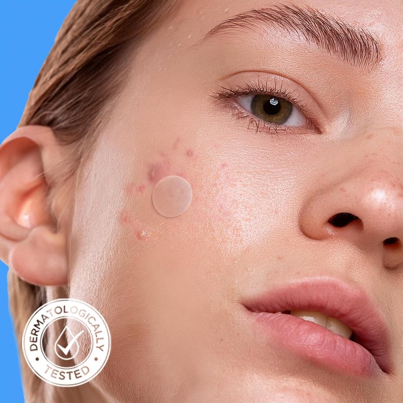 Acne Cover Patch - Hydrocolloid Pimple Patches with Tea Tree & Calendula Oil | Certified Vegan (24 Patches)