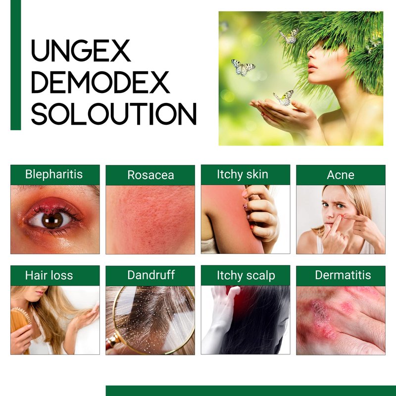 Premium Kit A2-i | Demodex Acne Rosacea Treatment | Ungex | PKA2-i