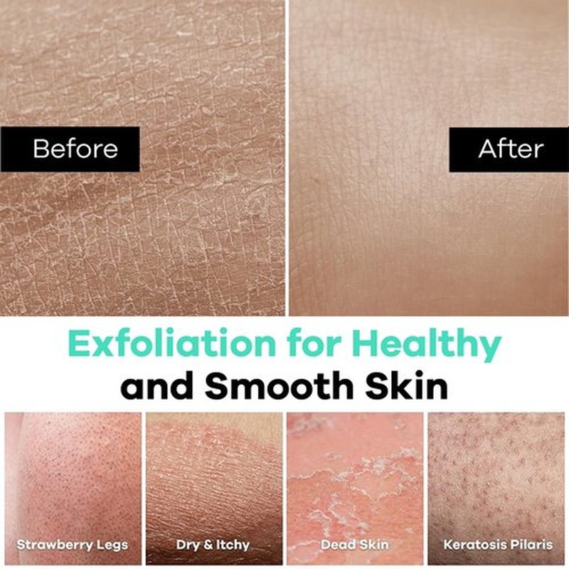 Dermasuri Deep Exfoliating Glove - Exfoliating Mitt Body Scrubber - Korean Skin Scrubber Exfoliator & Dead Skin Remover - Keratosis Pilaris Scrub - Spray Tan Remover - Shower Skincare (1 Pack)