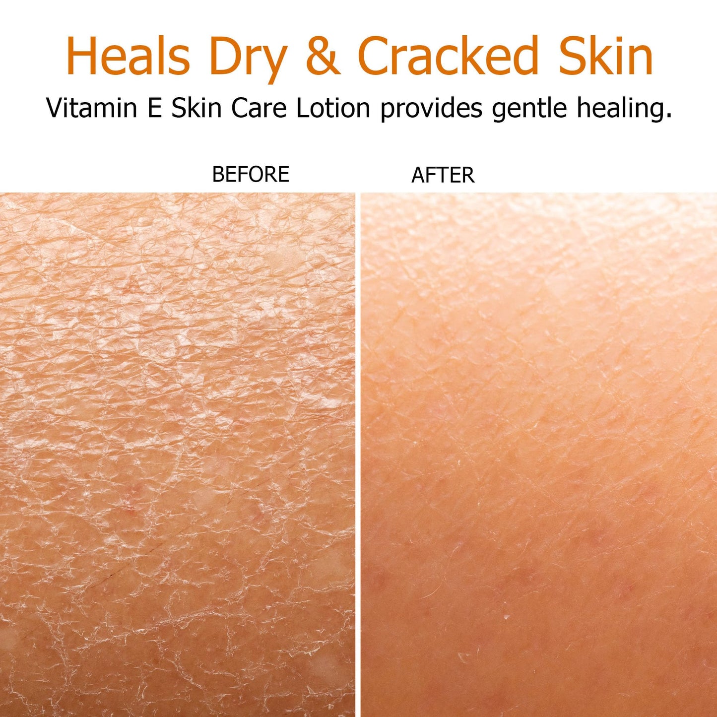 Fruit of the Earth, Vitamin E Lotion 16 oz (2 Pack), with Natural Antioxidants and Aloe Vera, Non-Greasy Formula