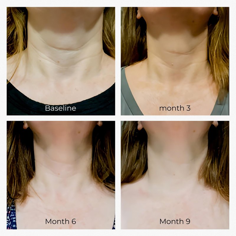 OBOGEE Neck Cream, Tighten & Lift Neck Cream - Anti-Aging Neck Creams for Tightening Lifting Sagging Skin and Hydrating- With Pro-Active Repair Firming Complex, 1.8 oz