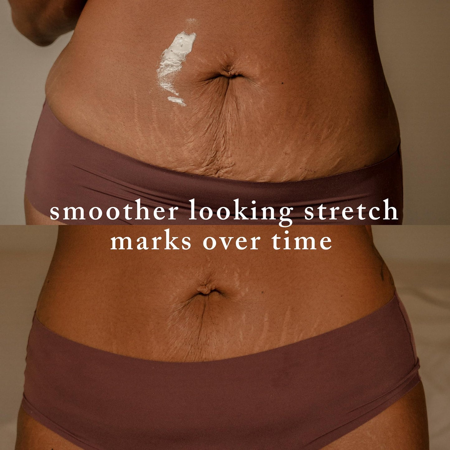 Nemah - Stretch Mark Cream for Pregnancy - Pregnancy Stretch Mark Prevention & Reduction, Postpartum Stretch Mark Cream with Vanistryl, Shea Butter, & Macadamia Oil - Vegan & Cruelty-Free - 3.5 oz.