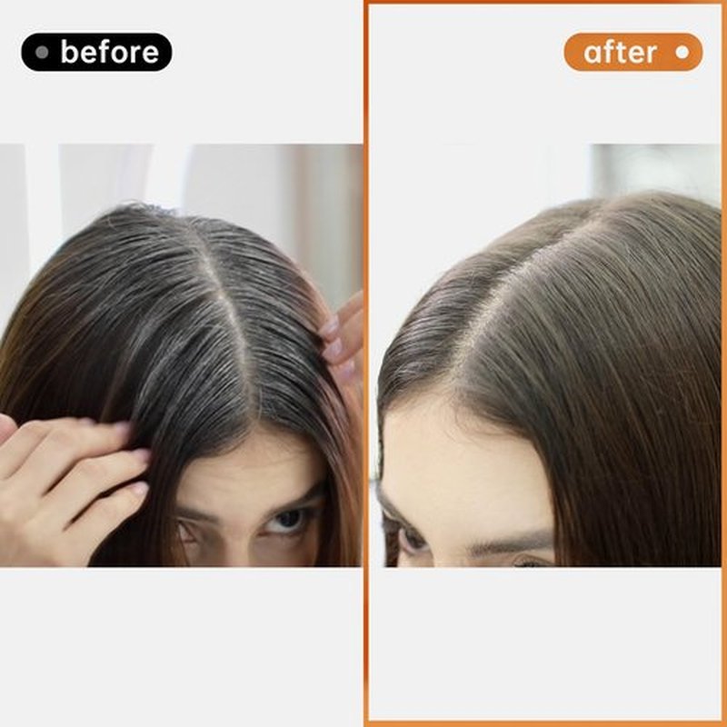 Happy Innocent Hair Dye Shampoo for Gray Hair-Chestnut Brown Hair Color Shampoo,4 In 1 Easy to use Natural&Long Lasting Looking Ammonia Free