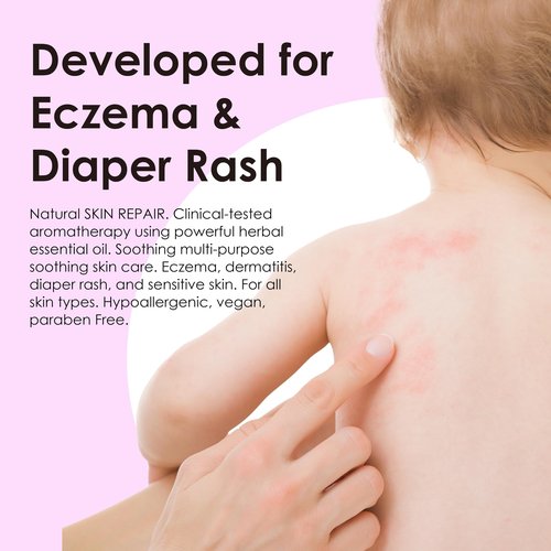 Natural SKIN REPAIR. Clinically tested Aromatherapy. Powerful Essential Oil. Eczema, Dermatitis, Diaper rash, and Sensitive skin. For all skin types. Hypoallergenic, Vegan, Paraben Free. 50ml bottle