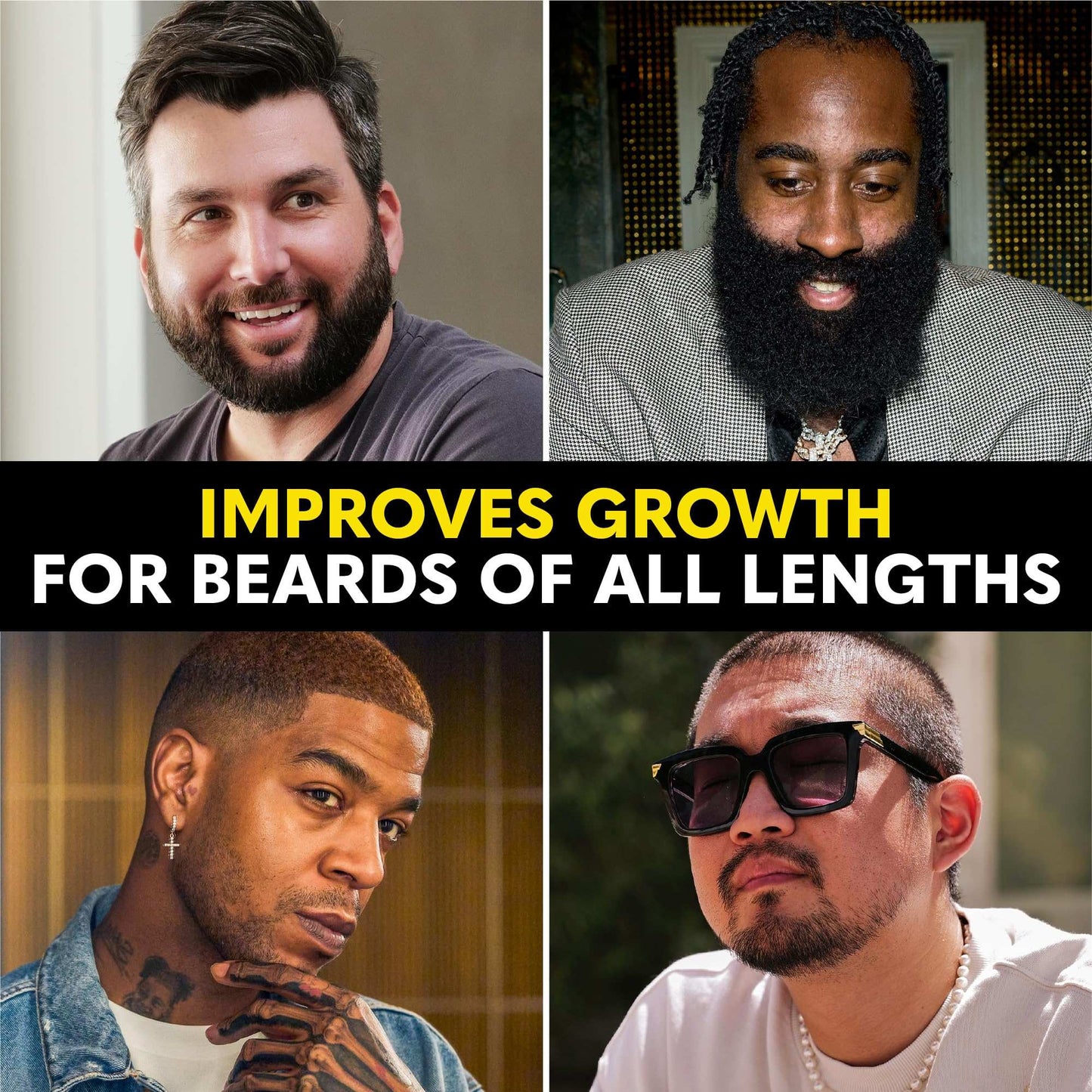 Beard Club - Beard Growth Serum with Natural Castor, Coconut and Avocado to Grow a Thicker, Fuller Beard, Fill in Patches and Stimulate Healthier Facial Hair Growth