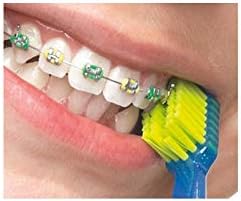 Curaprox Orthodontic Care Set – Complete Ortho Kit for Braces with Toothbrushes, Interdental Brushes & Wax | Swiss Quality