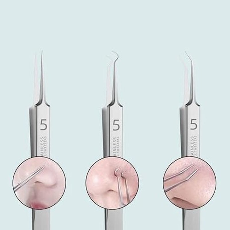 Usiveinborn Blackhead Remover, Usiveinborn Tweezers, Self Clip 0.05 Mm Tweezers, Professional Facial Blackhead Remover Tweezers, Blackhead Remover Tweezers (A)