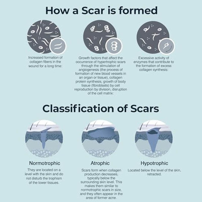 Silicone Scar Cream for Surgical and Bug Bite Scar Remover 0.73 Fl Oz - Scar Cream for New & Old Scars, C-Section and Burns - All Natural Acne Scar Cream for Face with Vitamin E, Retinol and Allantoin