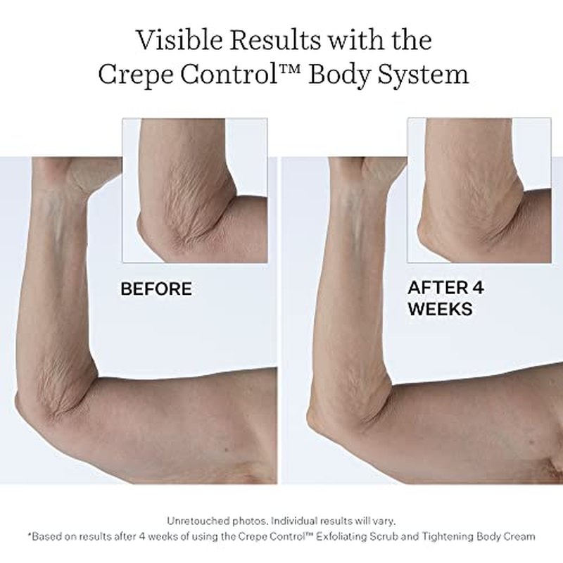 StriVectin Crepe Control™ Tightening Body Cream Jumbo, 10 oz, Body Cream for Hydration and Soft, Smooth Skin