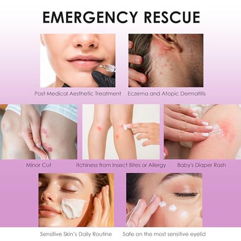 Natural SKIN REPAIR. Clinically tested Aromatherapy. Powerful Essential Oil. Eczema, Dermatitis, Diaper rash, and Sensitive skin. For all skin types. Hypoallergenic, Vegan, Paraben Free. 30ML TUBE