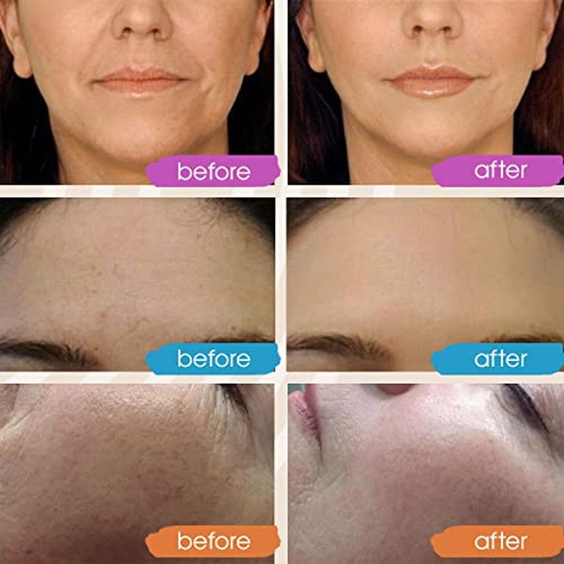 GLEOW Retinol Serum for Face - Vitamin C Face Serum with Hyaluronic Acid Serum for Face - Vitamin C Serum for Face - Retinol for Face - Hydrating Face Serum for Women and Men 3x1oz - Glow Face Serums