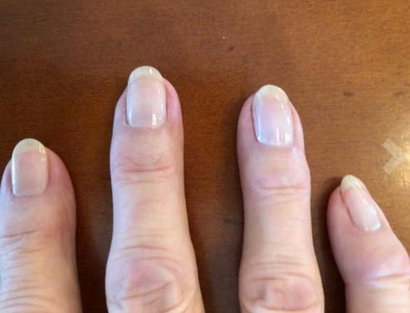 Karma Organic Deep Nutrition Nails Strengthener & 7 In 1 Elixir Nail Treatment makes your nails stronger and healty