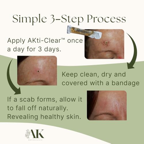 AKtiClear is formulated for use on Actinic Keratosis. Botanically-Infused Dermatological Skin Care Apply to Sun Damaged Skin Lesions right at Home. Fast 3-Day Application.