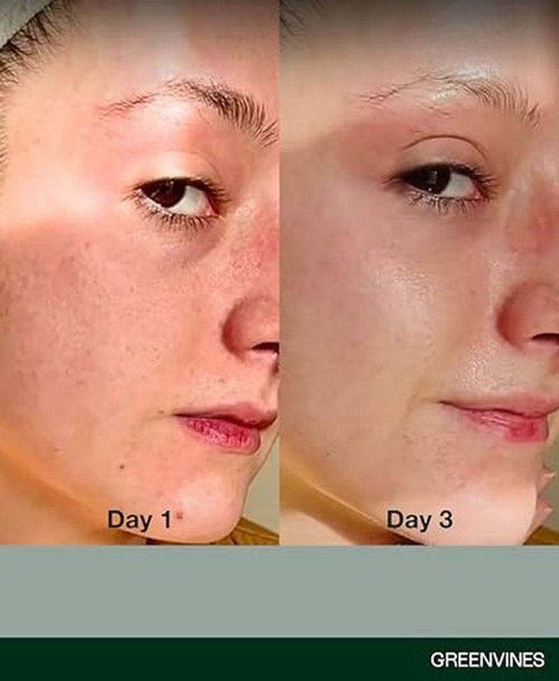 Greenvines Luminosity Hydrated & Anti-Aging Serum | Prevent Pre-mature Aging Sign for Smooth, Radiant Skin | Sensitive, Damaged Skin Work | 0.3 Fl oz