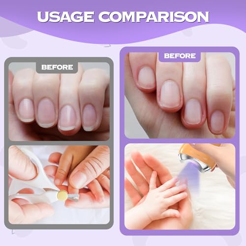 2 in 1 Electric Polishing Automatic Nail Clippers with LED Light,Electric Nail Clipper,Safe Fingernail & Toenail Clippers 3-Speed Automatic Nail Trimmer for Kids, Adults, Elderly (Black)