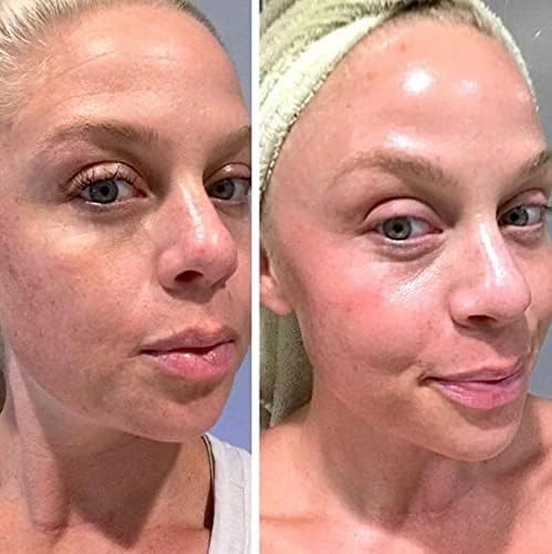 Retinol Gel 0.1% - Anti-Aging Treatment for Fine Lines, Wrinkles & Scars | 20 Grams