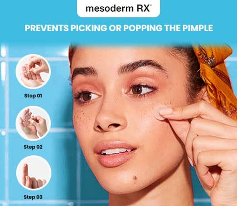 Hydrocolloid Acne Patch - Mesoderm RX Pimple Treatment Stickers for Face & Skin | 72 Count