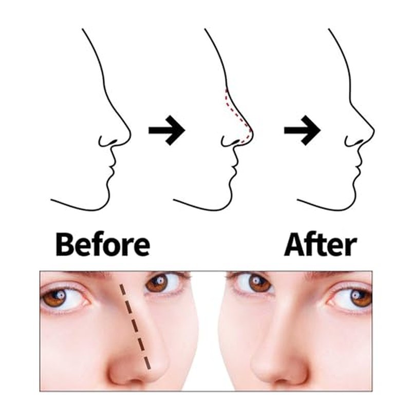 SOZOOM PDO Thread Nose Lift, PDO Cog Threads Improve the Shape of the Nasal Columella and Alar L-Blunt Type Cog Thread Lift (16pcs-19G-38mm (l))