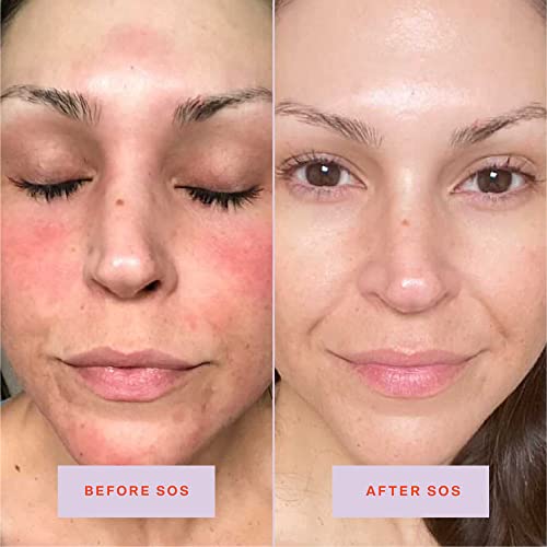 Tower 28 SOS Daily Rescue Facial Spray for Sensitive Skin, Hypochlorous Acid Spray Helps Reduce Redness and Breakouts, Travel Size Toner for Face, 1 FL Oz