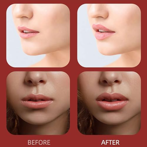 RJSQAQE Electric Lip Vacuum Plumper,Lip Plumper Device,Lip Enhancer Plumper Tool,Automatic Lip Enhancer Fuller Device,Bigger Lip Suction Plumper Tool,3 Gears Lip Augmentation Beauty Device (Black)