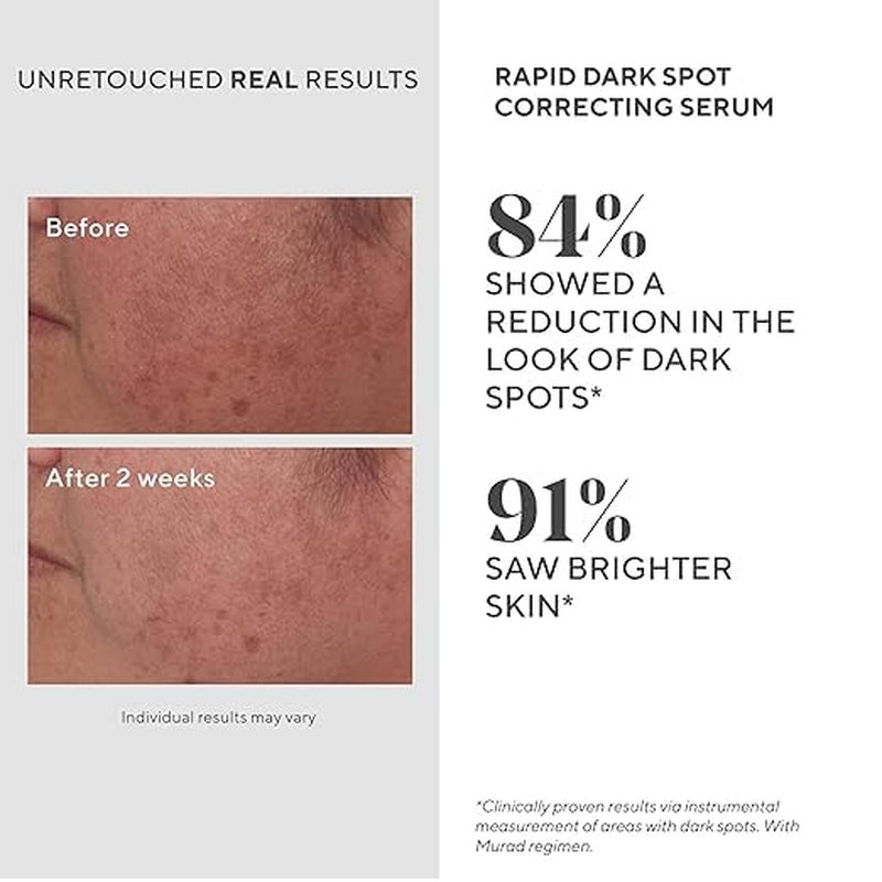Murad Bright Eyed & Spotless Combo - Retinol Eye & Dark Spot Serums for Discoloration & Fine Lines | Set of 2