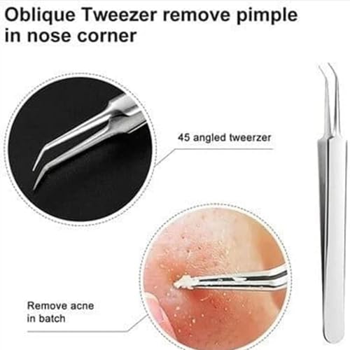 Usiveinborn Blackhead Remover, Usiveinborn Tweezers, Professional Stainless Steel Facial Blackhead Remover Tweezers, Blackhead Tweezers, Blackhead Remover Tweezers Set (C)