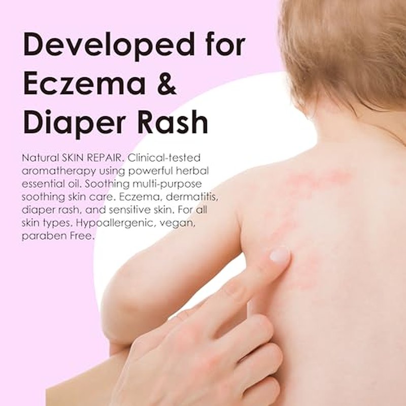 Natural SKIN REPAIR. Clinically tested Aromatherapy. Powerful Essential Oil. Eczema, Dermatitis, Diaper rash, and Sensitive skin. For all skin types. Hypoallergenic, Vegan, Paraben Free. 30ML TUBE