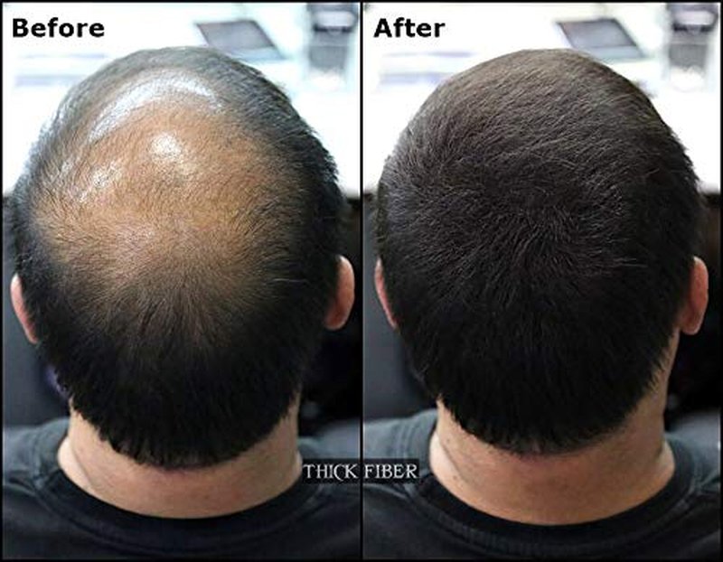 THICK FIBER Hair Fibers for Thinning Hair & Bald spots (BLACK) - 25g Bottle - Conceals Hair Loss in Seconds - Hair Powder for Women & Men