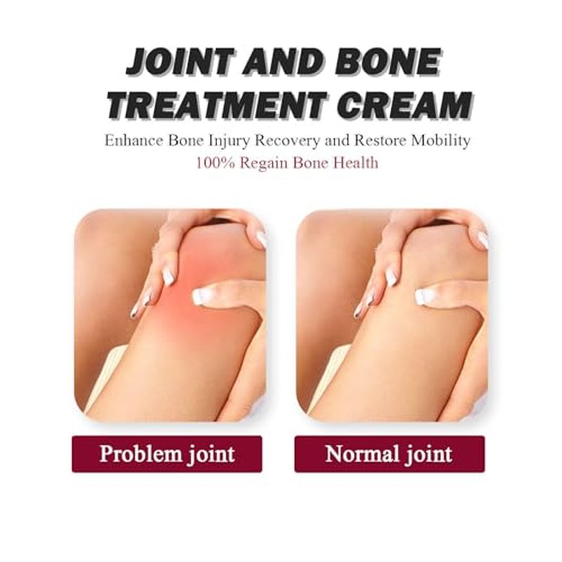Surllow 3PCS Perfectx Joint & Bone Cream, Perfectx Cream
