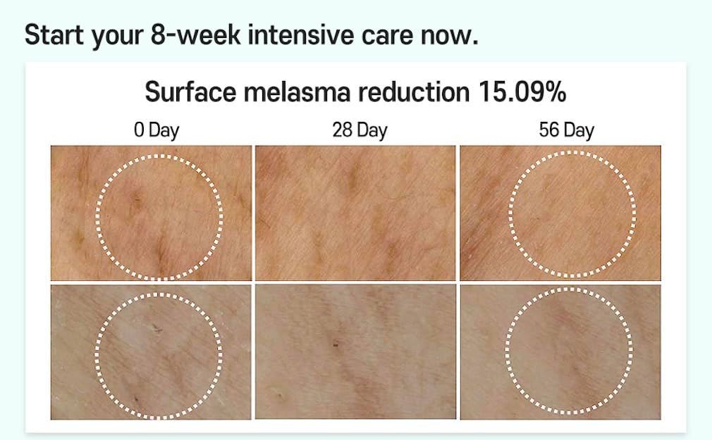 Melasma treatment for Face Cica Intensive Serum 1.01fl.oz/30ml