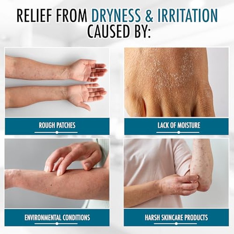 GLY MIRACLE Moisturizing Body Cream for Extremely Dry Skin, Non-Greasy Skin Humectant for Hands, Body & Feet, Body Lotion for Extremely Dry Skin, Non-Oily, with Glycerin, Original Fresh Scent 16 Ounce
