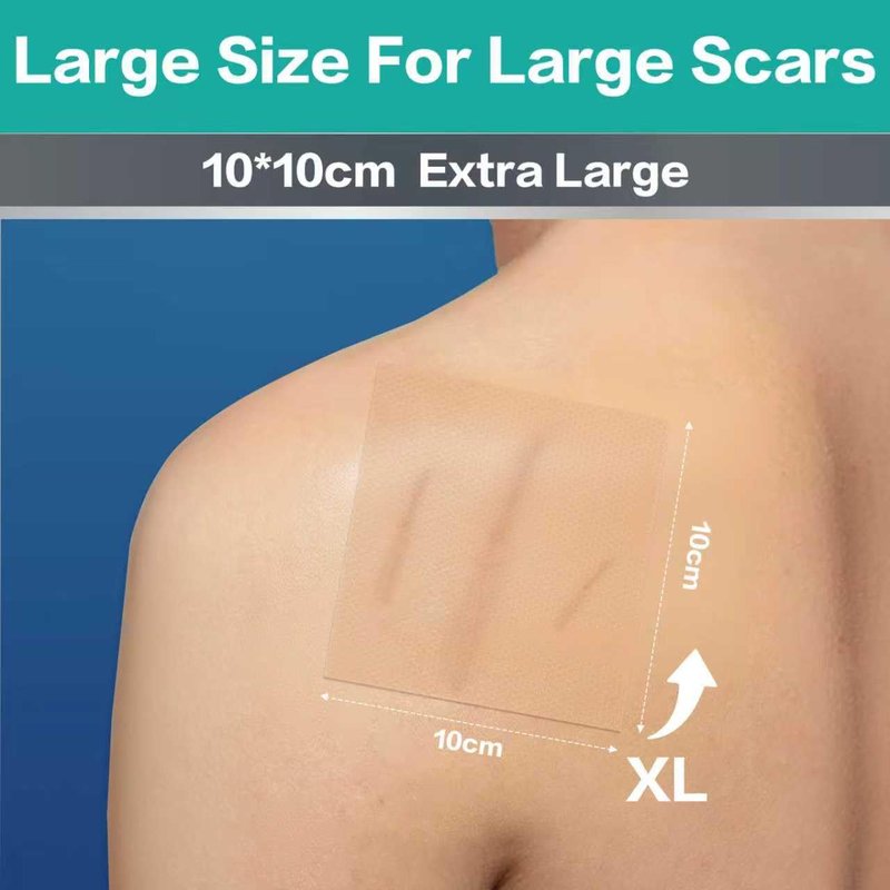 Medical Grade Silicone Scar Sheets - Advanced Treatment for Surgical, Burn & Keloid Scars | Flexible 4"x4" Strips