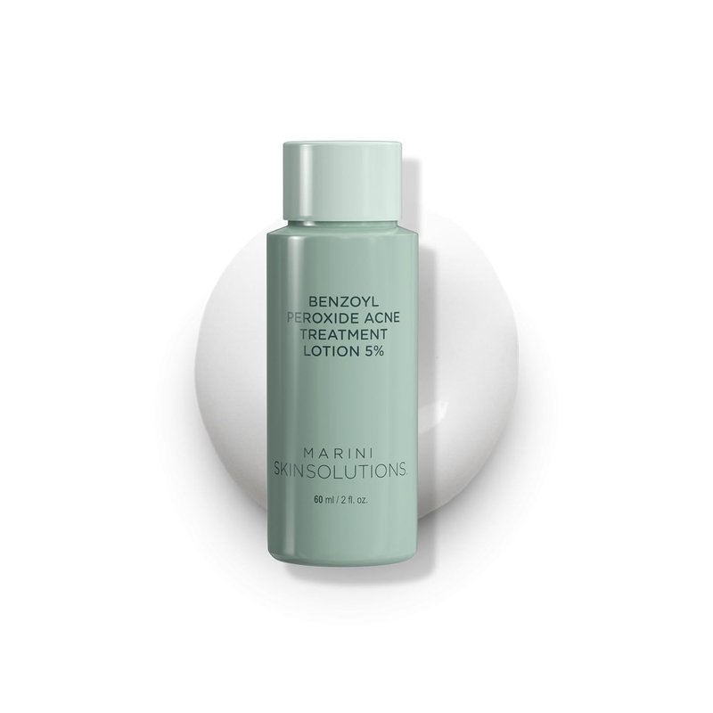 Benzoyl Peroxide Acne Treatment Lotion 5% - Effective for Acne-Prone Skin | Clears Pores & Excess Oil - 2 fl oz