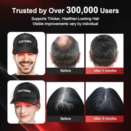 CAYAMA Red Light Therapy Cap for Hair ? 510 LEDs Laser Hair Cap for Fuller, Healthier-Looking Hair, Light-Based Care Device for Men & Women