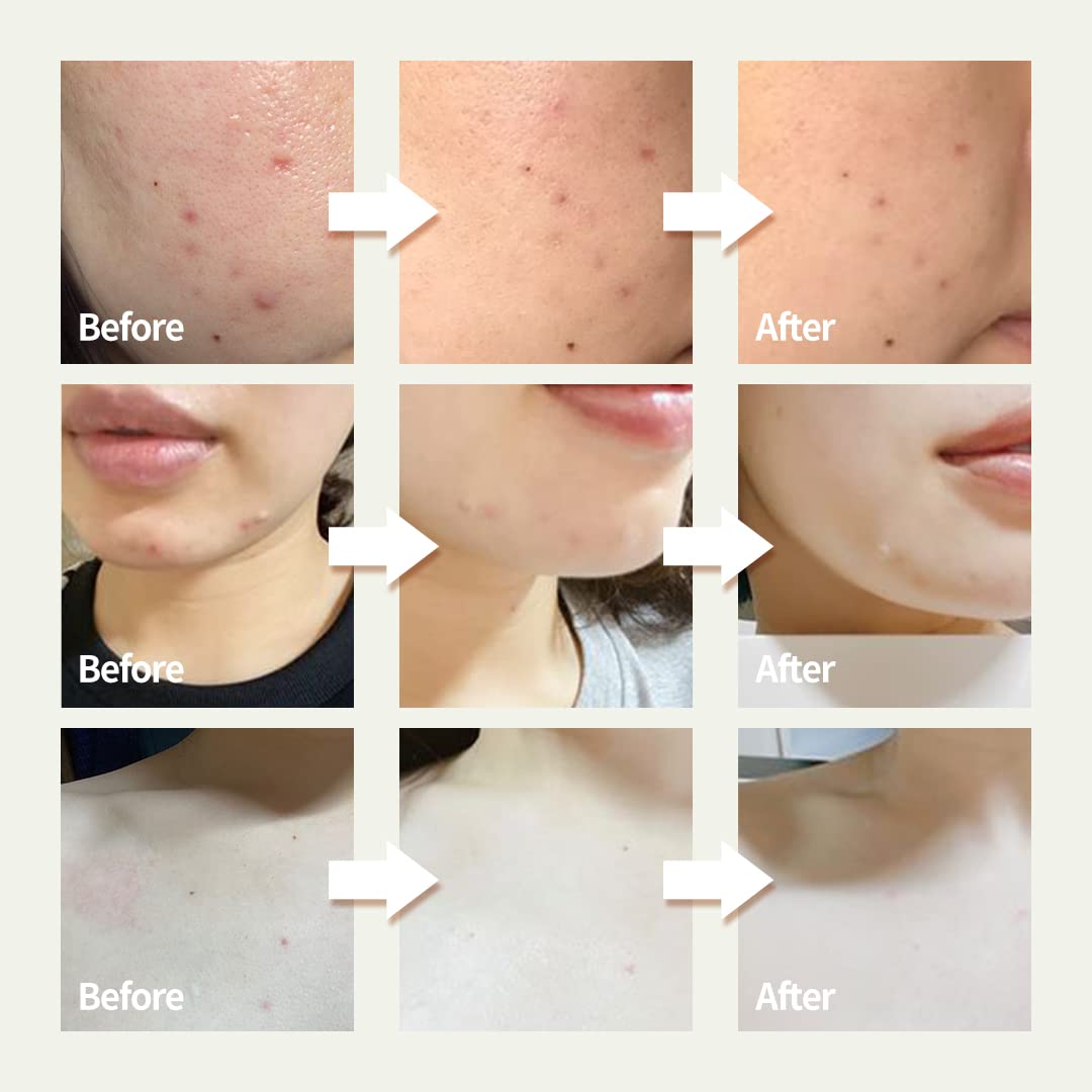OxygenCeuticals Skin Barrier Ato Cream – Protective Cream with Fucoidan V, Shea Butter & Centella Asiatica, Strengthen Skin Barrier & Soothe Sensitive Skin. 0.67 fl.oz (20ml)