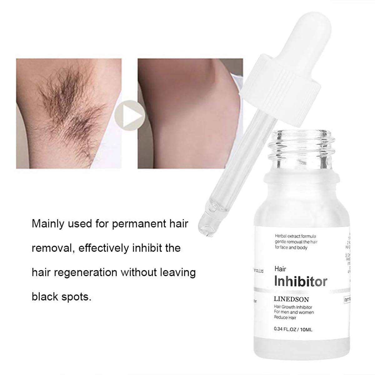 Generic Mild Hair Growth Inhibitor Serum,for Face, Arm, Legs Body Hair, Unscented, 0.34 Fl Oz, Lotion, Natural Plant Extract, Unisex