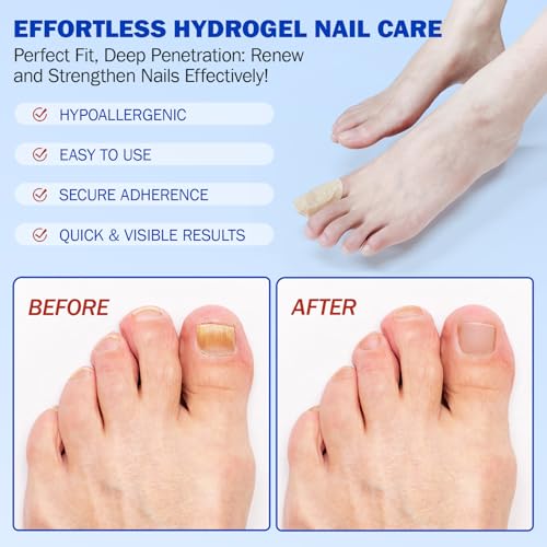 Nail Patches 42 PCS Toenail Treatment Extra Strength 8-Hour Overnight Nail Fast Acting Repair Effortless Hydrogel Nail Care and Repair for Damaged Nails Overnight Renewal for Men and Women