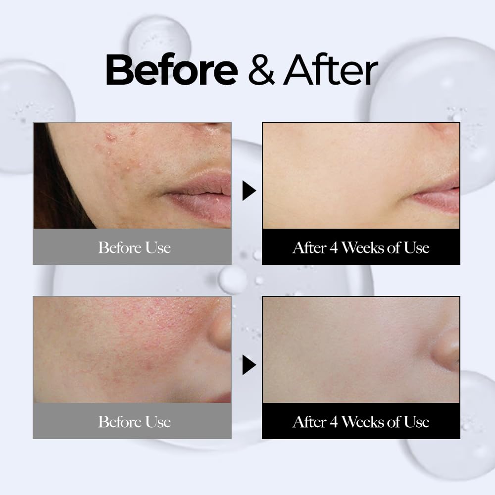 CELL29 Gen3 Hyclair Serum Ampoule 3-Layer Hyaluronic Acid 10 Species Acne Treatment Daily Face Moisturizer Propolis & Collagen 100-Hour Long-Lasting Formula All Skin Types Glass Skin Korean 3.38 Fl.oz