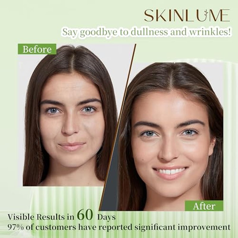 Jade Roller Gua Sha Facial Tool - For Face Neck Eye Jawline, Reduce Puffiness and Tension, Gift Set for Men Woman 100% Natural Jade Stone - SkinLume (Green)