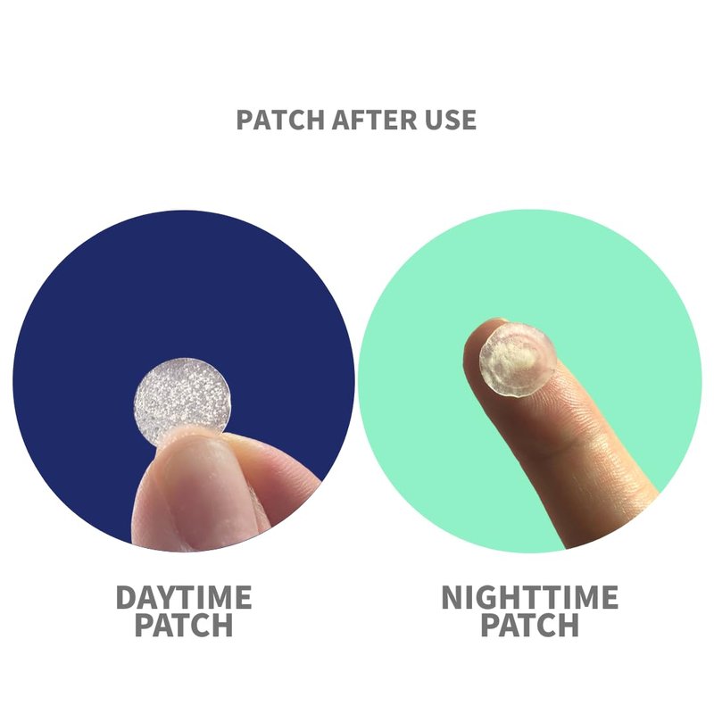 Blemish Patch Day & Night - Hydrocolloid Spot Patches for Face | 72 Invisible Clear Stickers, Tapered Edge
