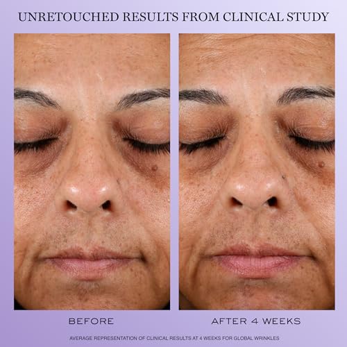 Lanc?me R?nergie H.P.N. 300-Peptide Anti-Aging Face Cream with Hyaluronic Acid, Niacinamide & 300 Peptides - Visibly Reduces Wrinkles, Dark Spots & Sagging Skin